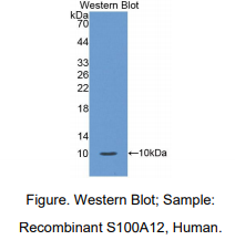 https://msimg.bioon.com/bionline/goods-no-pic.png