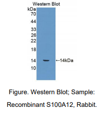 兔S100钙结合蛋白A12(S100A12)多克隆抗体