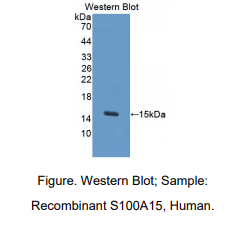 人S100钙结合蛋白A15(S100A15)多克隆抗体