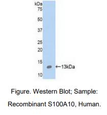 https://msimg.bioon.com/bionline/goods-no-pic.png