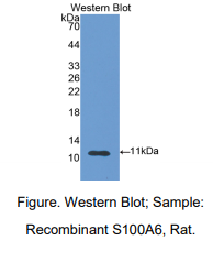 https://msimg.bioon.com/bionline/goods-no-pic.png