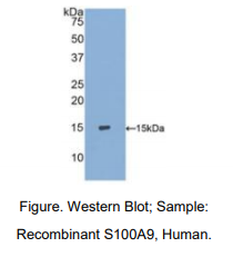 https://msimg.bioon.com/bionline/goods-no-pic.png