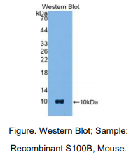 小鼠S100钙结合蛋白B(S100B)多克隆抗体
