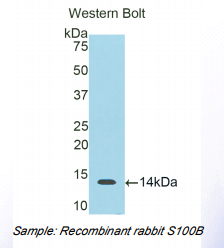 兔S100钙结合蛋白B(S100B)多克隆抗体