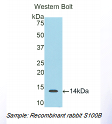 https://msimg.bioon.com/bionline/goods-no-pic.png