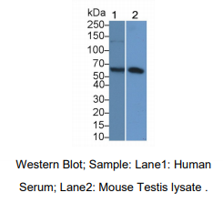 https://msimg.bioon.com/bionline/goods-no-pic.png