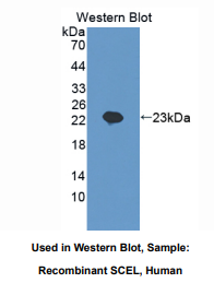 https://msimg.bioon.com/bionline/goods-no-pic.png