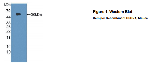 小鼠Sestrin 1蛋白(SESN1)多克隆抗体