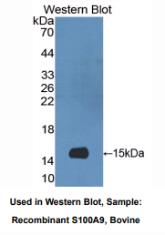 牛S100钙结合蛋白A9(S100A9)多克隆抗体