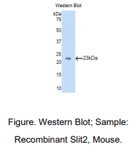 小鼠Slit同源物2(Slit2)多克隆抗体