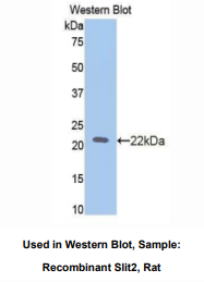 大鼠Slit同源物2(Slit2)多克隆抗体