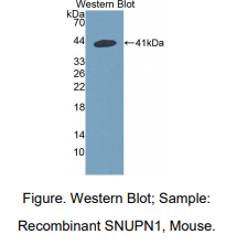 https://msimg.bioon.com/bionline/goods-no-pic.png