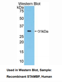 https://msimg.bioon.com/bionline/goods-no-pic.png