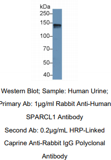 https://msimg.bioon.com/bionline/goods-no-pic.png