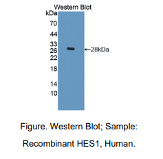 https://msimg.bioon.com/bionline/goods-no-pic.png