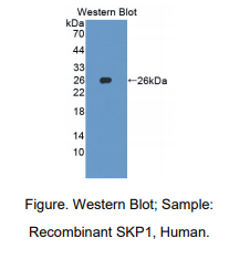 https://msimg.bioon.com/bionline/goods-no-pic.png