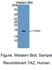 https://msimg.bioon.com/bionline/goods-no-pic.png