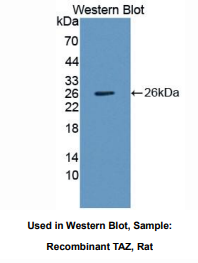 https://msimg.bioon.com/bionline/goods-no-pic.png