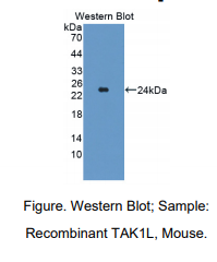 https://msimg.bioon.com/bionline/goods-no-pic.png