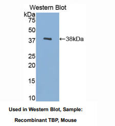 https://msimg.bioon.com/bionline/goods-no-pic.png