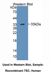 人Tec蛋白酪氨酸激酶(TEC)多克隆抗体