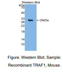 https://msimg.bioon.com/bionline/goods-no-pic.png