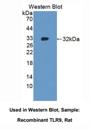 https://msimg.bioon.com/bionline/goods-no-pic.png