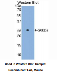 https://msimg.bioon.com/bionline/goods-no-pic.png