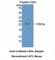 https://msimg.bioon.com/bionline/goods-no-pic.png