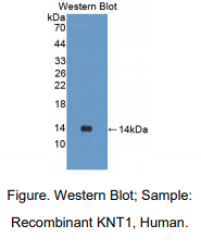 https://msimg.bioon.com/bionline/goods-no-pic.png