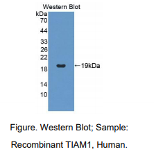 人T-细胞淋巴瘤侵袭转移诱导蛋白1(TIAM1)多克隆抗体