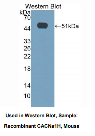 小鼠T-型电压依赖钙离子通道α1H亚基(CACNa1H)多克隆抗体