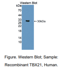 https://msimg.bioon.com/bionline/goods-no-pic.png