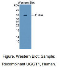人UDP-葡萄糖糖蛋白糖基转移酶1(UGGT1)多克隆抗体