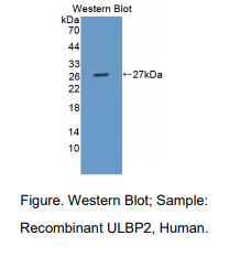 人UL16结合蛋白2(ULBP2)多克隆抗体