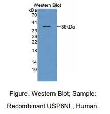 https://msimg.bioon.com/bionline/goods-no-pic.png