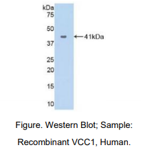 人VEGF共调节趋化因子1(VCC1)多克隆抗体