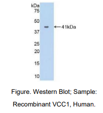 https://msimg.bioon.com/bionline/goods-no-pic.png