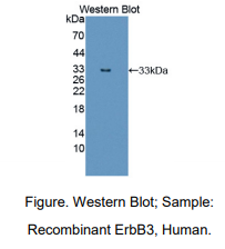 人V-Erb B2红白血病病毒癌基因同源物3(ErbB3)多克隆抗体