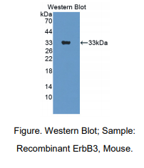 小鼠V-Erb B2红白血病病毒癌基因同源物3(ErbB3)多克隆抗体