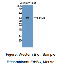 https://msimg.bioon.com/bionline/goods-no-pic.png