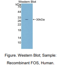 https://msimg.bioon.com/bionline/goods-no-pic.png