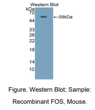 https://msimg.bioon.com/bionline/goods-no-pic.png