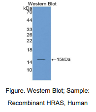 https://msimg.bioon.com/bionline/goods-no-pic.png