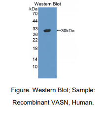 人Vasorin蛋白(VASN)多克隆抗体
