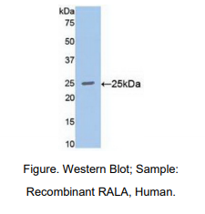 https://msimg.bioon.com/bionline/goods-no-pic.png