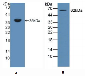 https://msimg.bioon.com/bionline/goods-no-pic.png