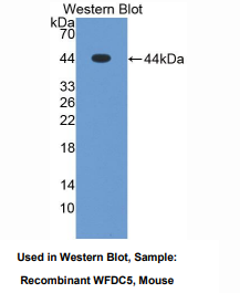 小鼠WAP四二硫化物核心域蛋白5(WFDC5)多克隆抗体
