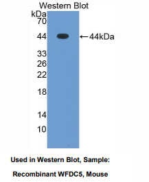 https://msimg.bioon.com/bionline/goods-no-pic.png