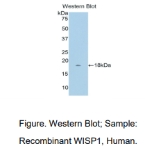 人WNT1诱导信号通道蛋白1(WISP1)多克隆抗体